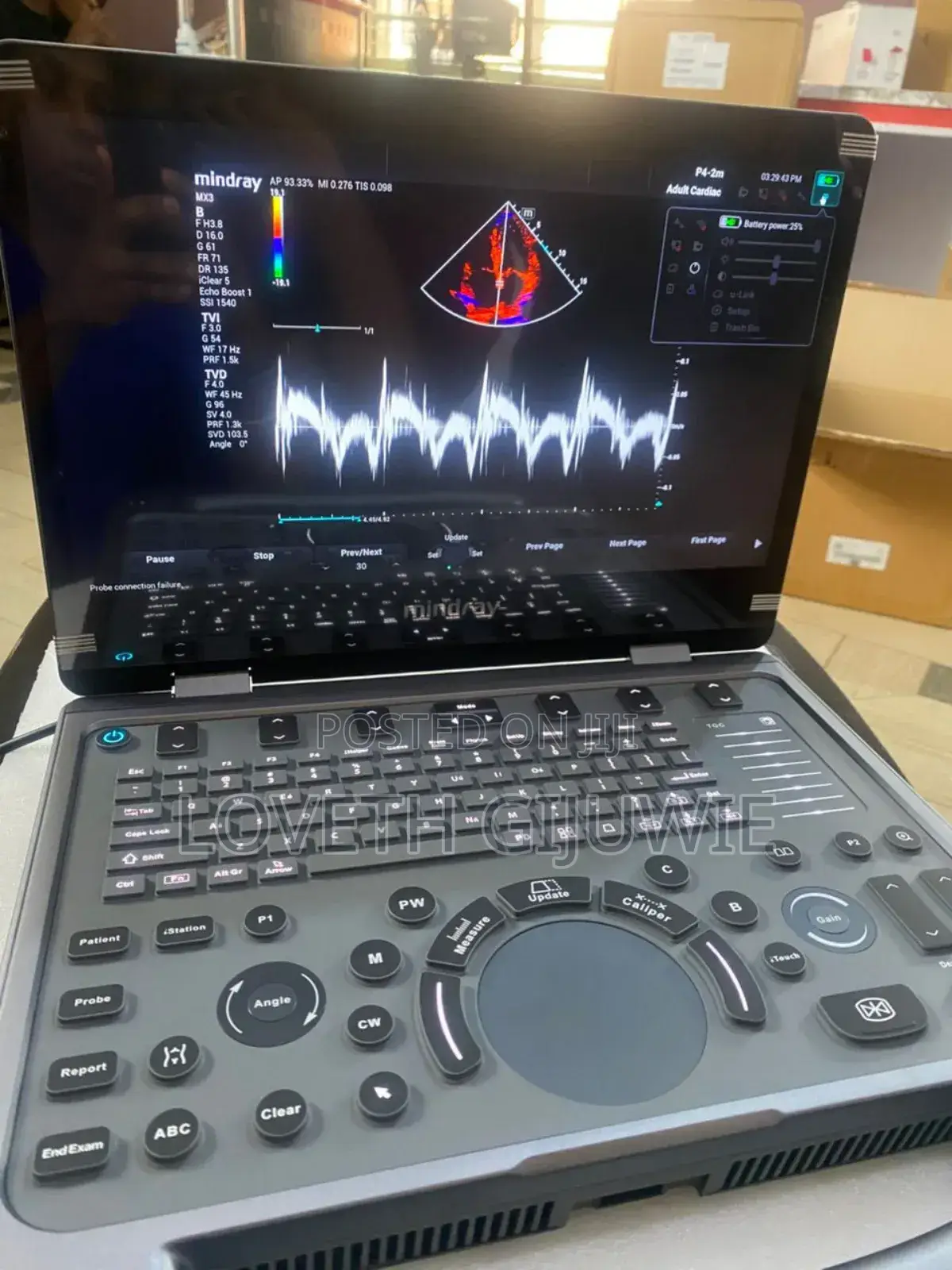 Mindray Mx3 Ultrasound Machine