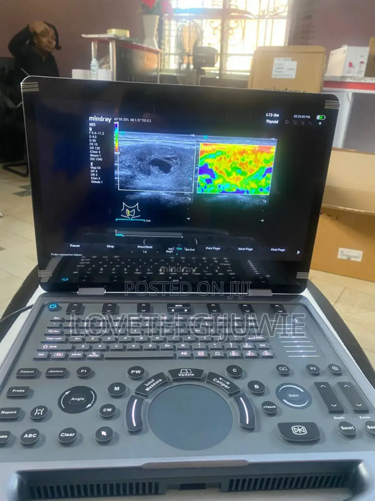 Mindray Mx3 Ultrasound Machine