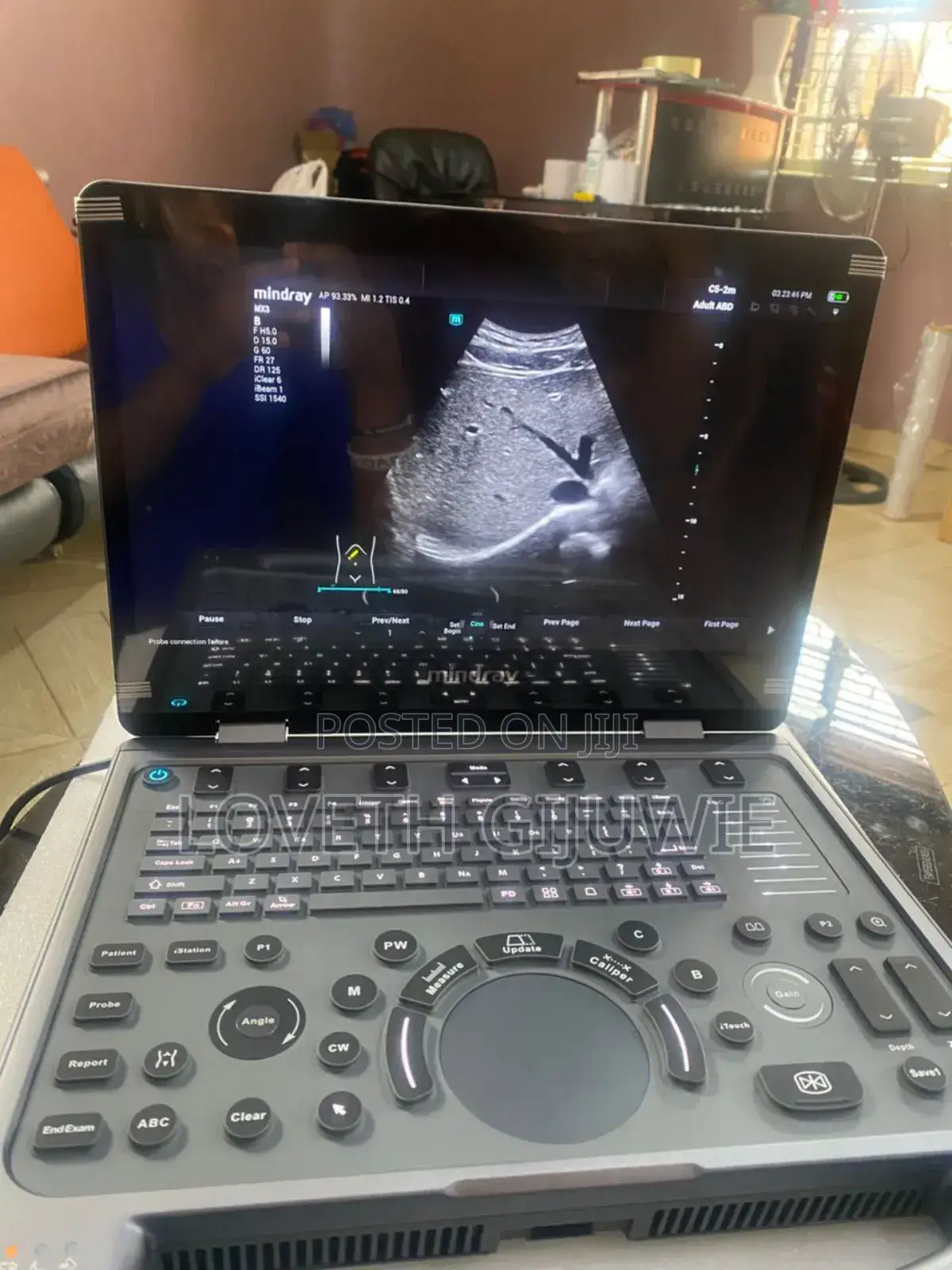 Mindray Mx3 Ultrasound Machine
