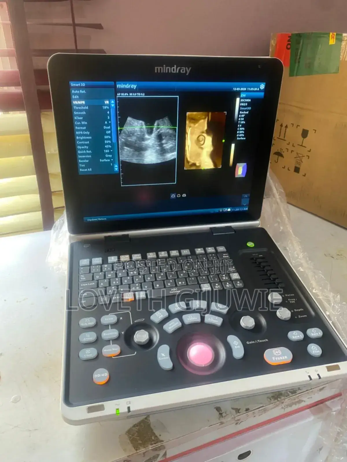 Mindray Z50 Ultrasound Machine