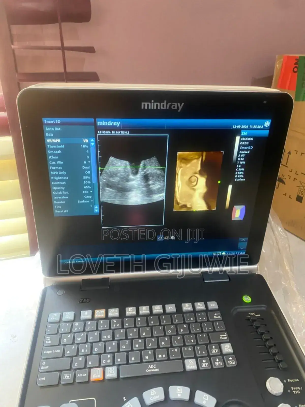 Mindray Z50 Ultrasound Machine