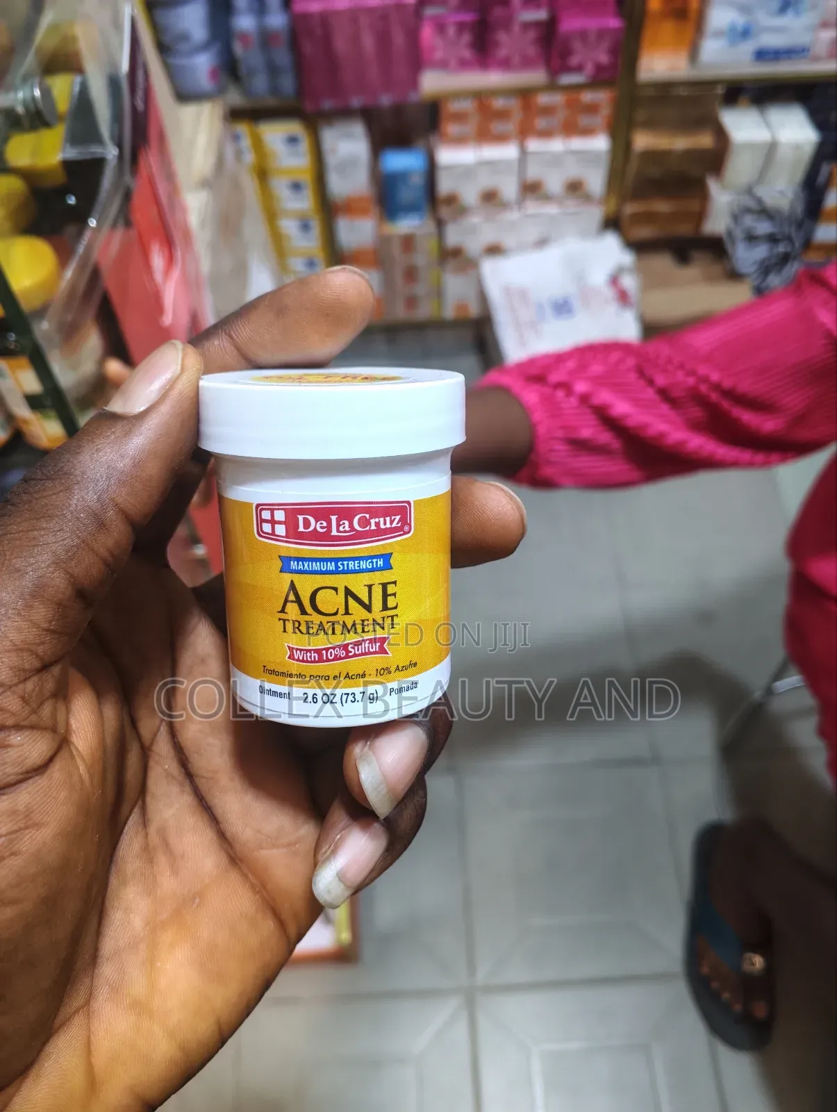 De La Cruz Acne Treatment