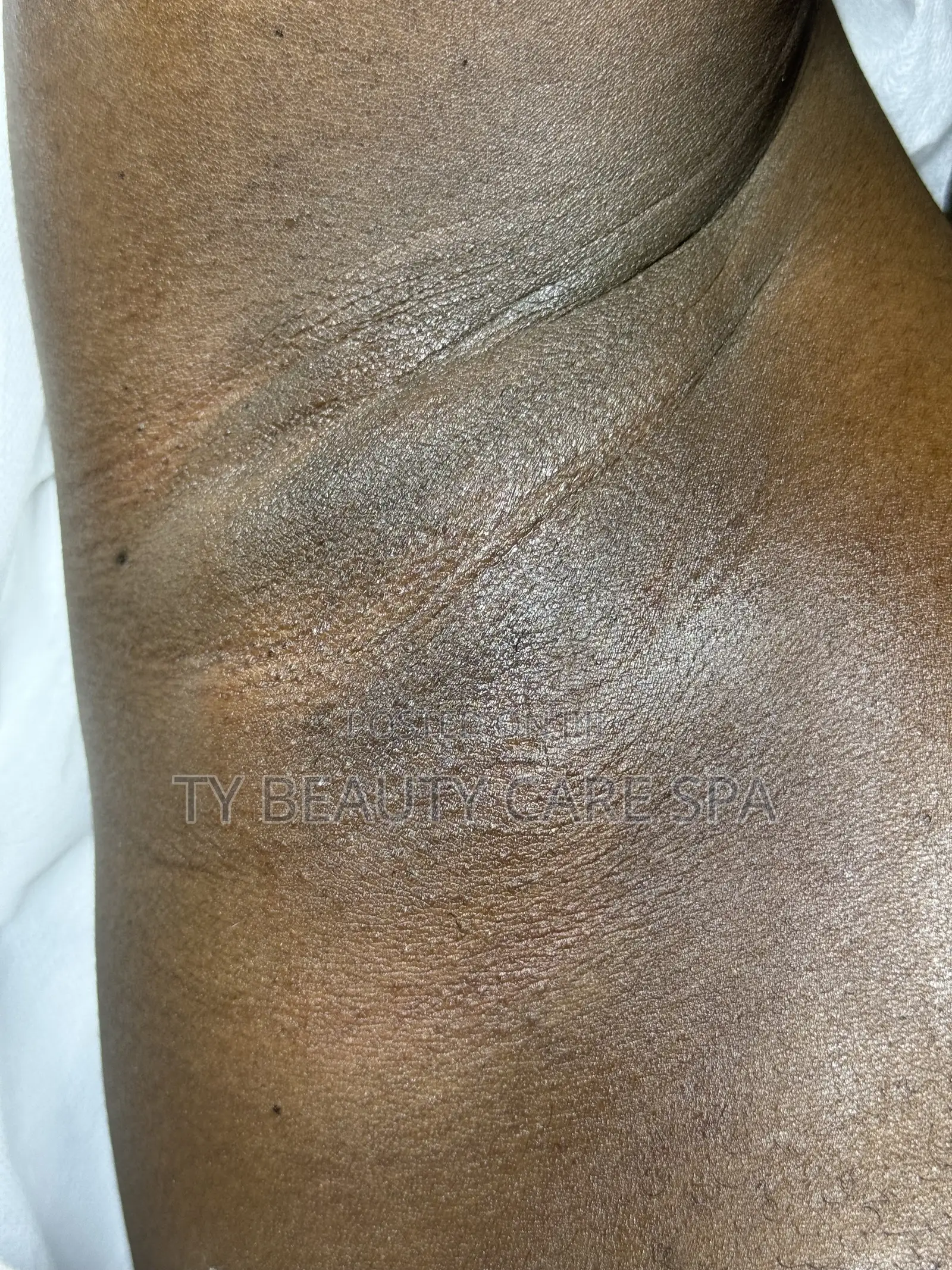 Waxing (Hair Removal)