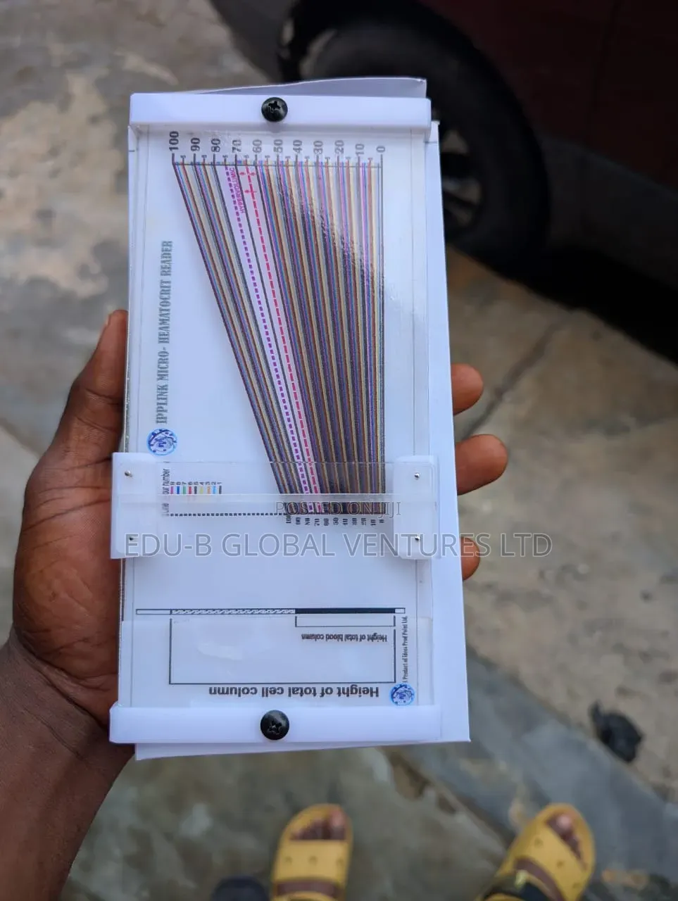 Hematocrit Reader