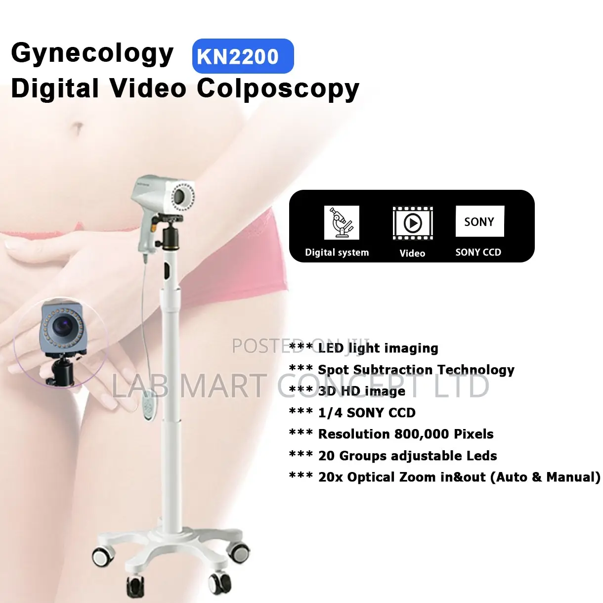 Gynecology Video Colposcope