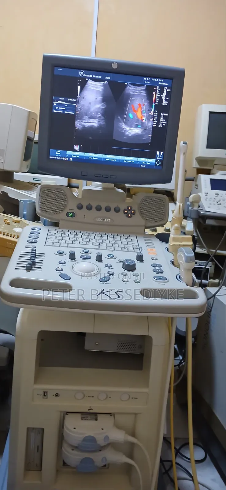 Ge Logic P5 Color Doppler
