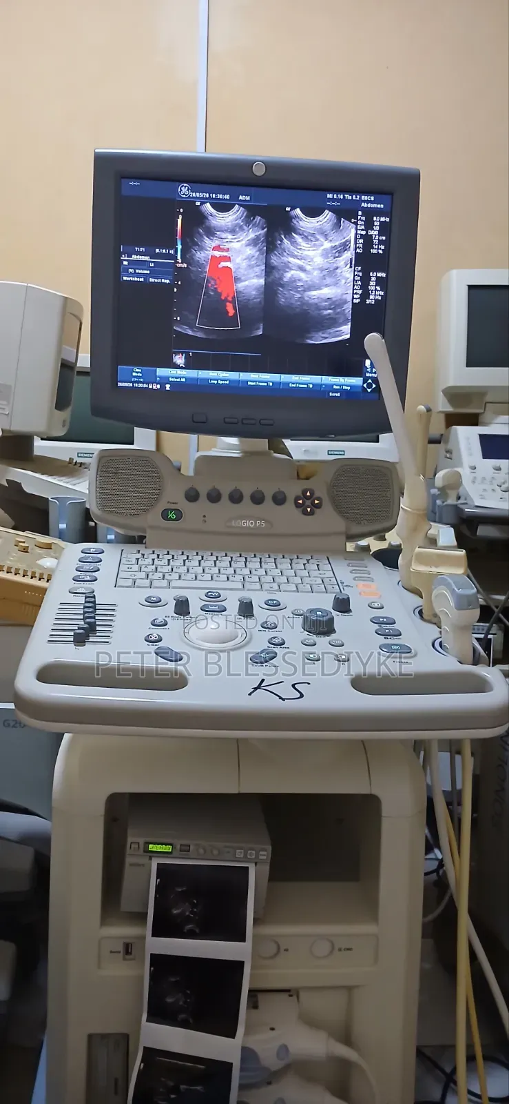 Ge Logic P5 Color Doppler