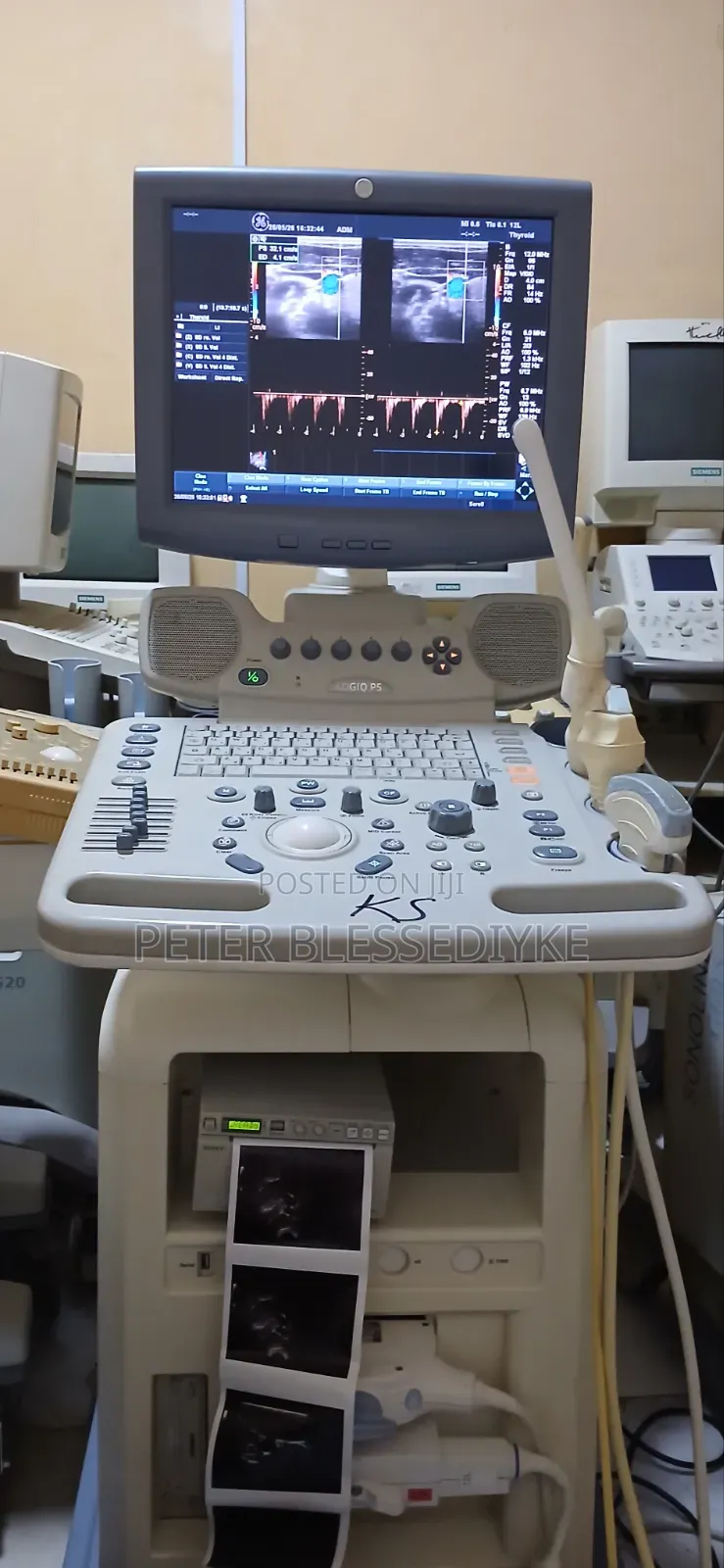 Ge Logic P5 Color Doppler