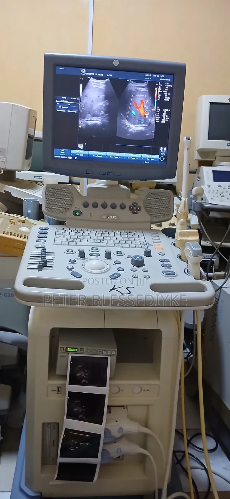 Ge Logic P5 Color Doppler