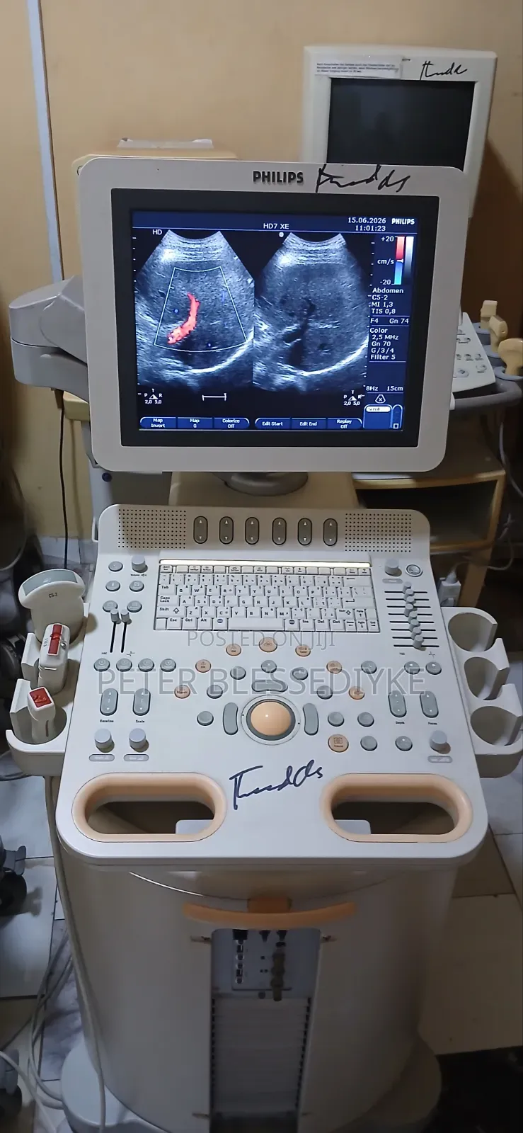 Philips Hd7 Color Doppler Echo
