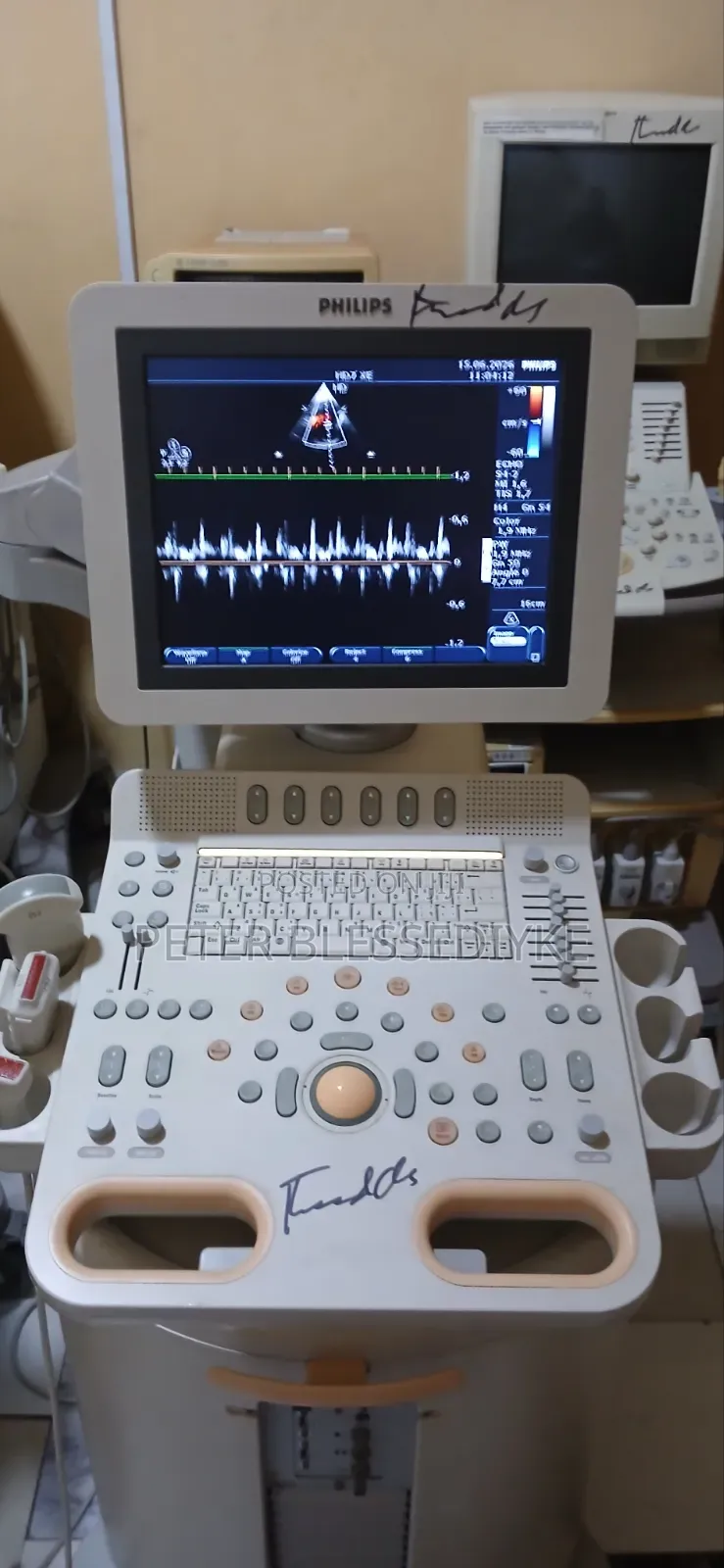 Philips Hd7 Color Doppler Echo