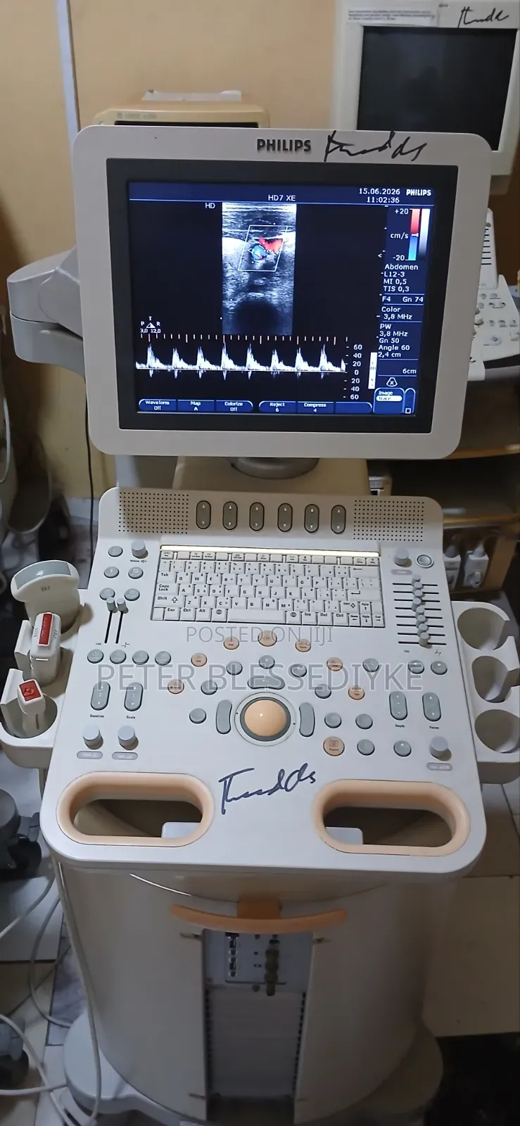 Philips Hd7 Color Doppler Echo