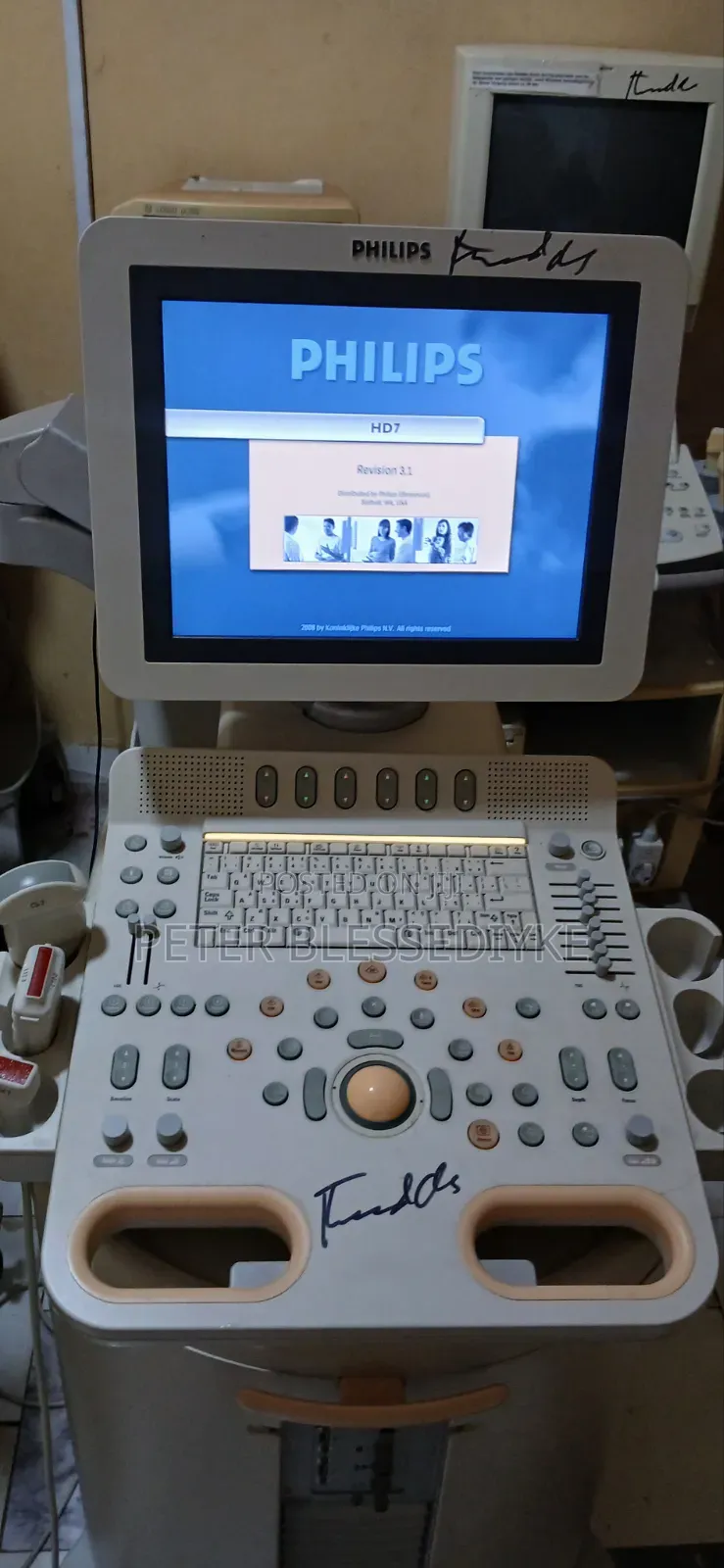 Philips Hd7 Color Doppler Echo
