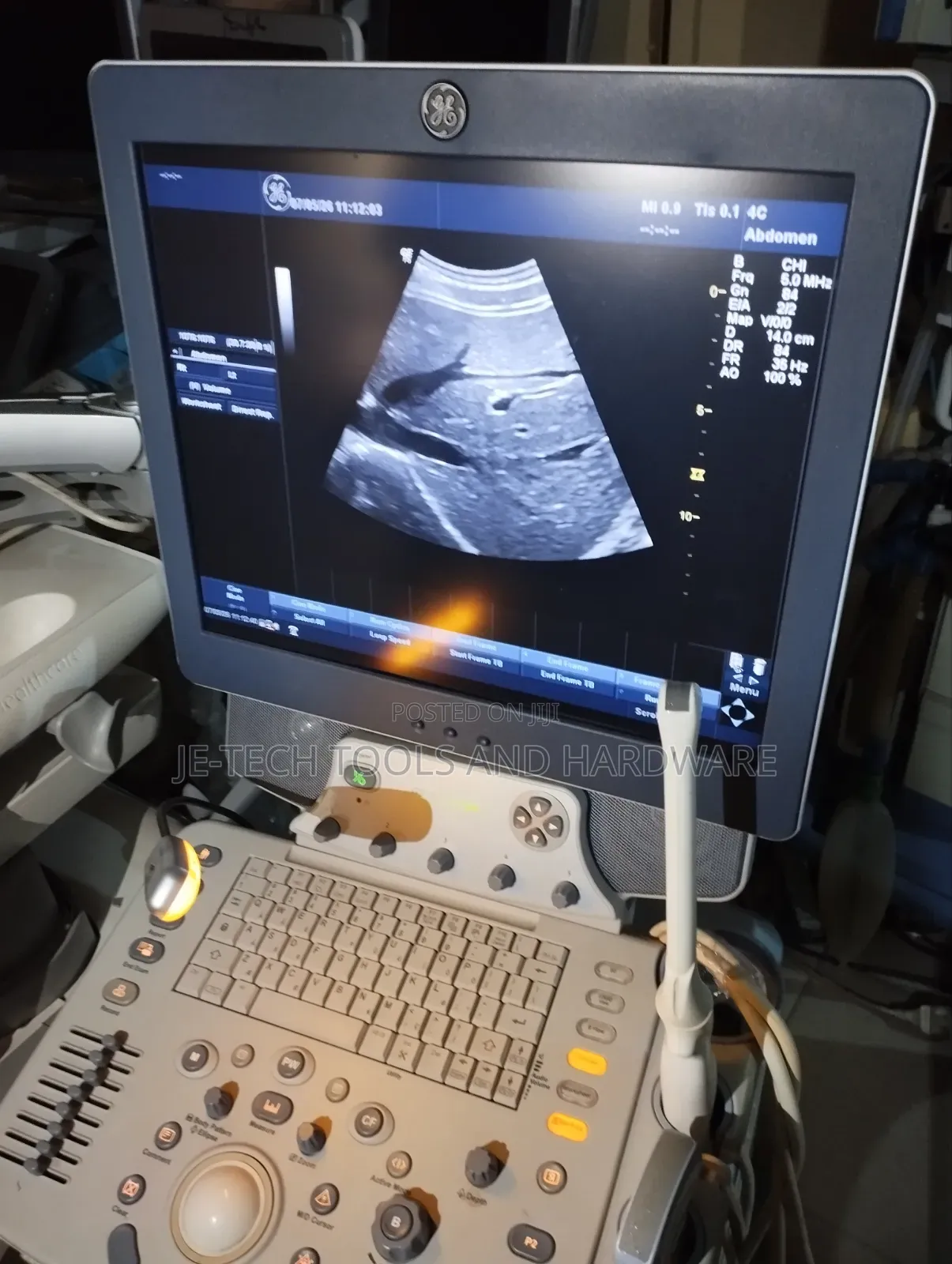 2d Color Doppler Ge Logiq P6 Ultrasound (Cardiac)
