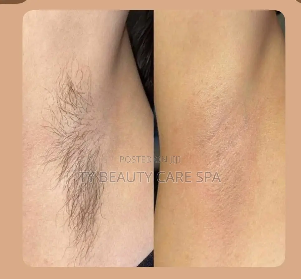 Under Arm Waxing Services