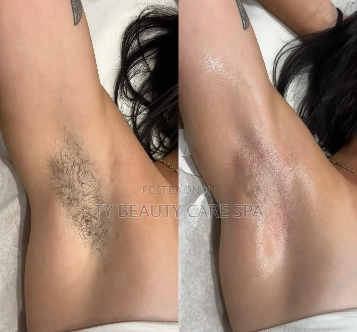 Under Arm Waxing Services