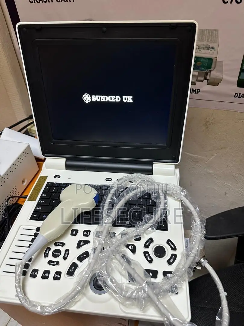 Sunmed Uk Laptop Ultrasound Machine
