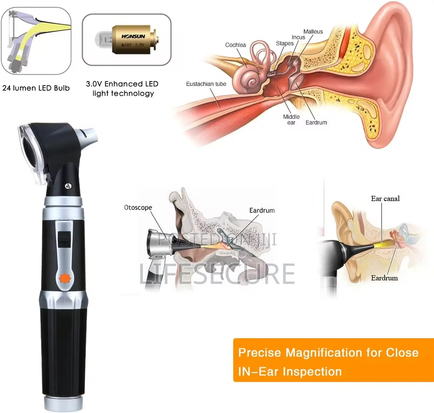 Optical Otoscope Ear Infection Detector