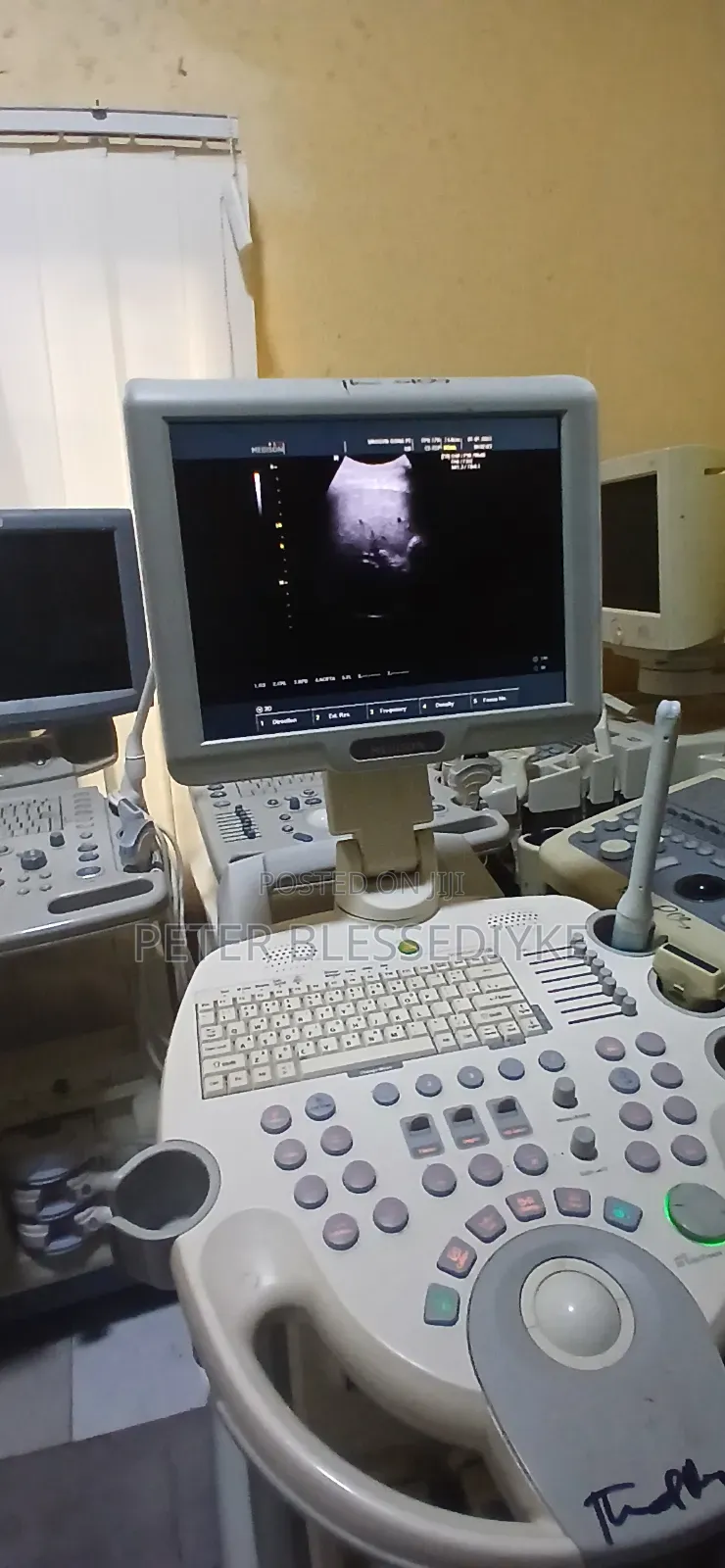 Samsung Medson Sonoace X6 2D Colour Doppler