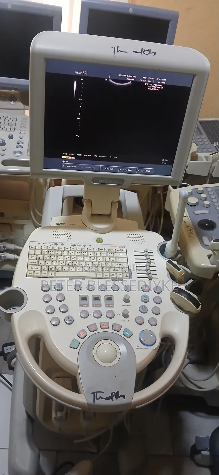 Samsung Medson Sonoace X6 2D Colour Doppler
