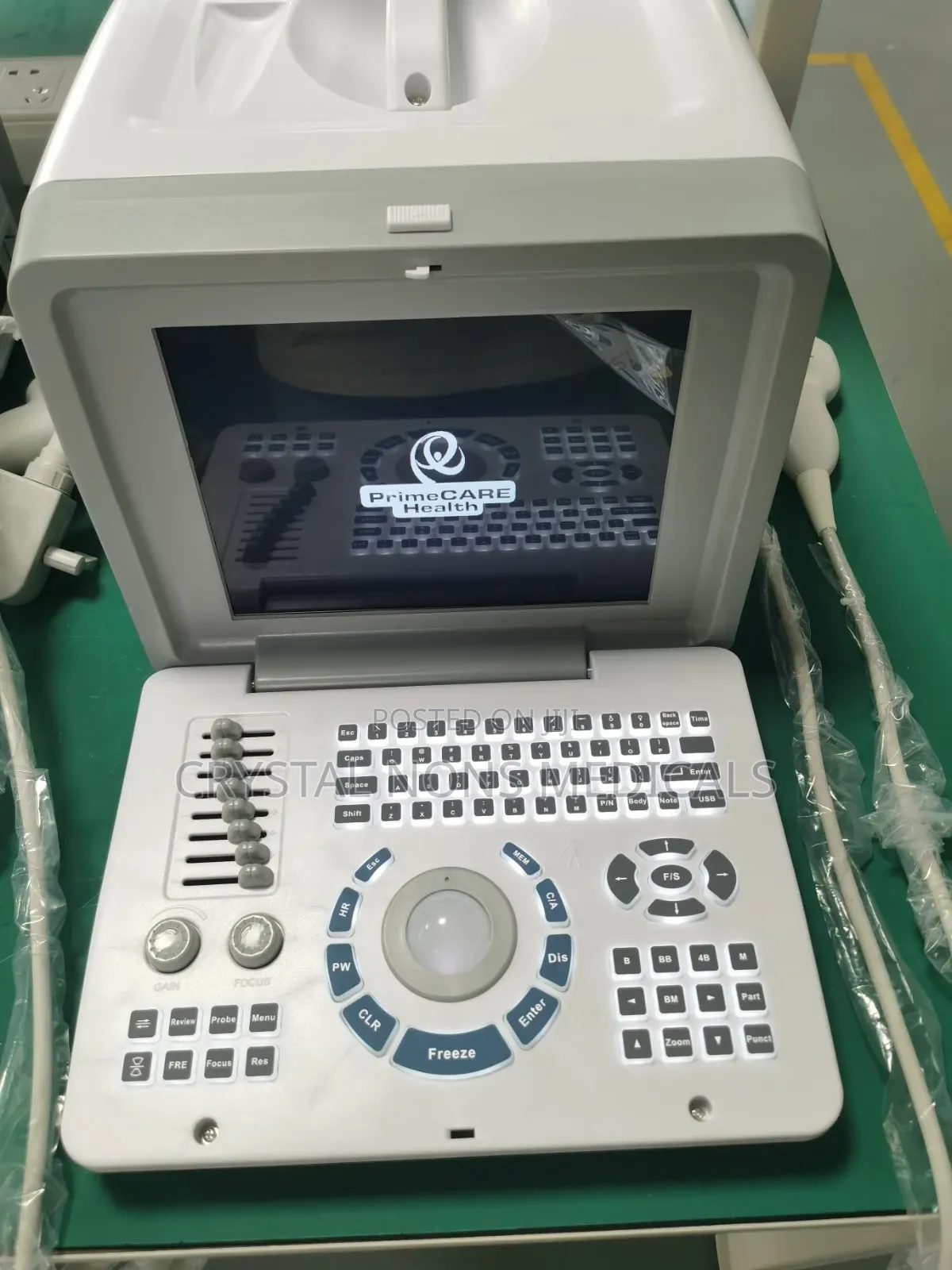 Ultrasound Monitor