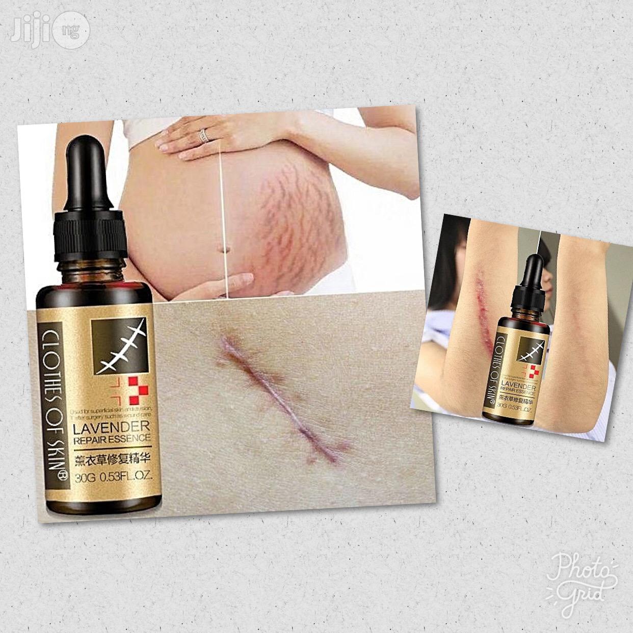Wicked Scars And Stretch Marks Removal