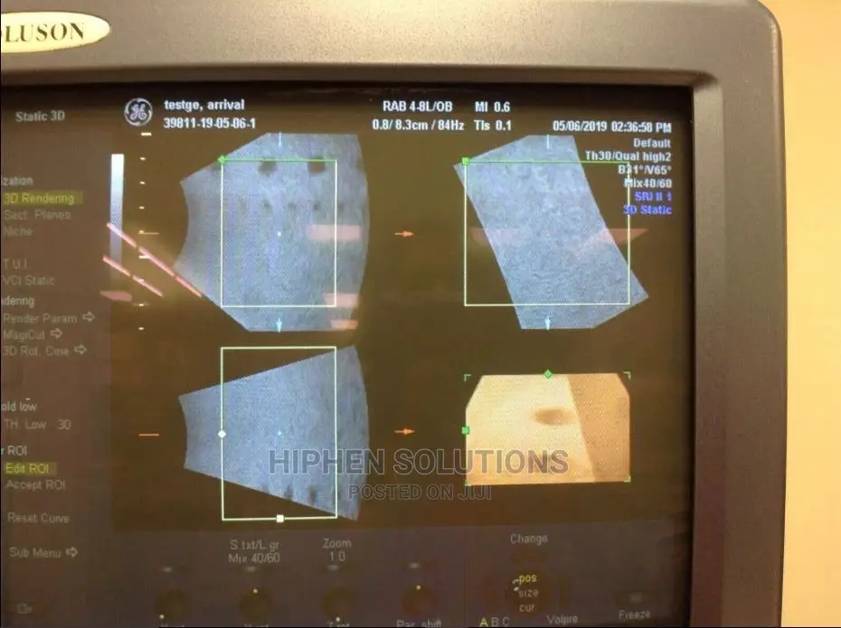 Voluson 730 Ultrasound System