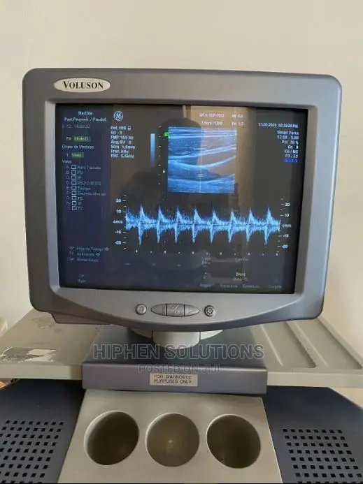 Ultra-sound Imaging System Voluson 730 Pro