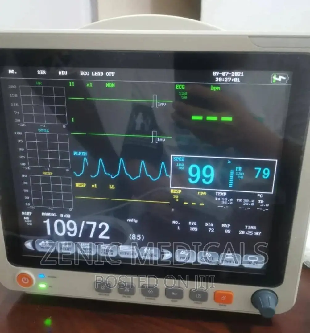 Patient Monitor