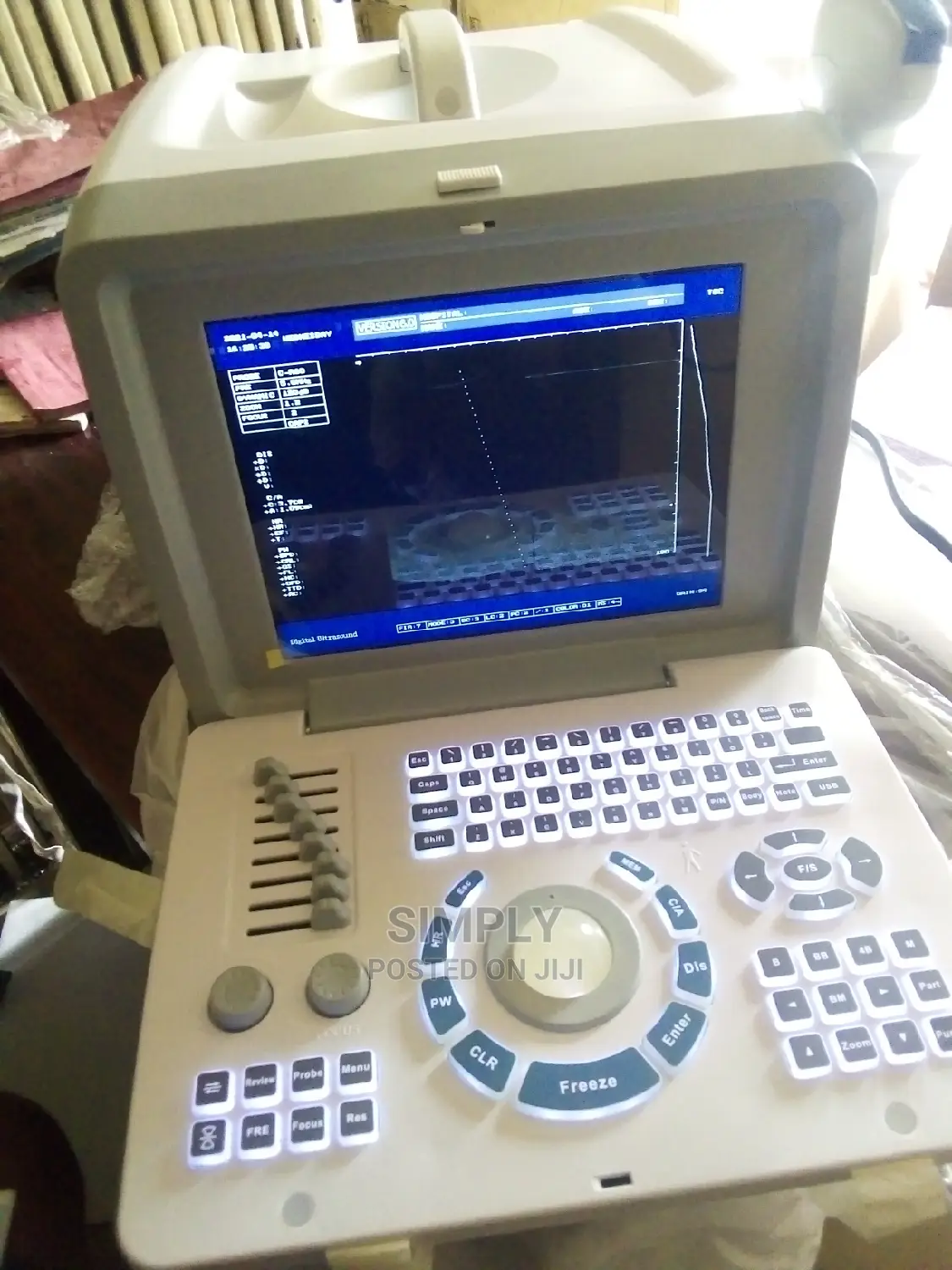 Ultrasound Scan Manchine