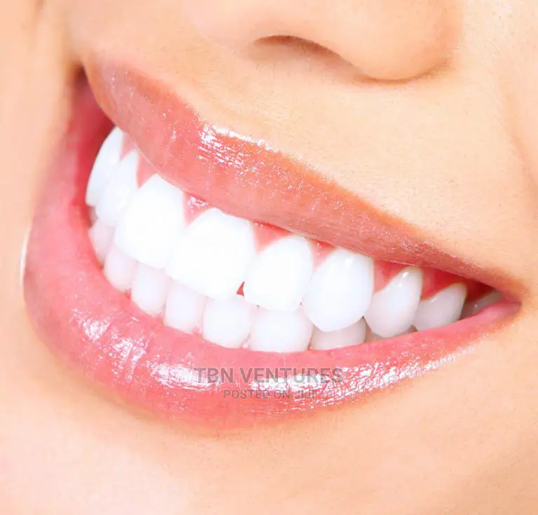 All Dental Care: Braces, Teeth Scaling, Polishing, Whitening