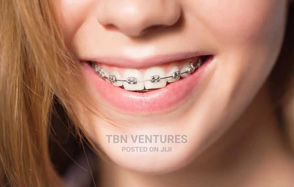 All Dental Care: Braces, Teeth Scaling, Polishing, Whitening