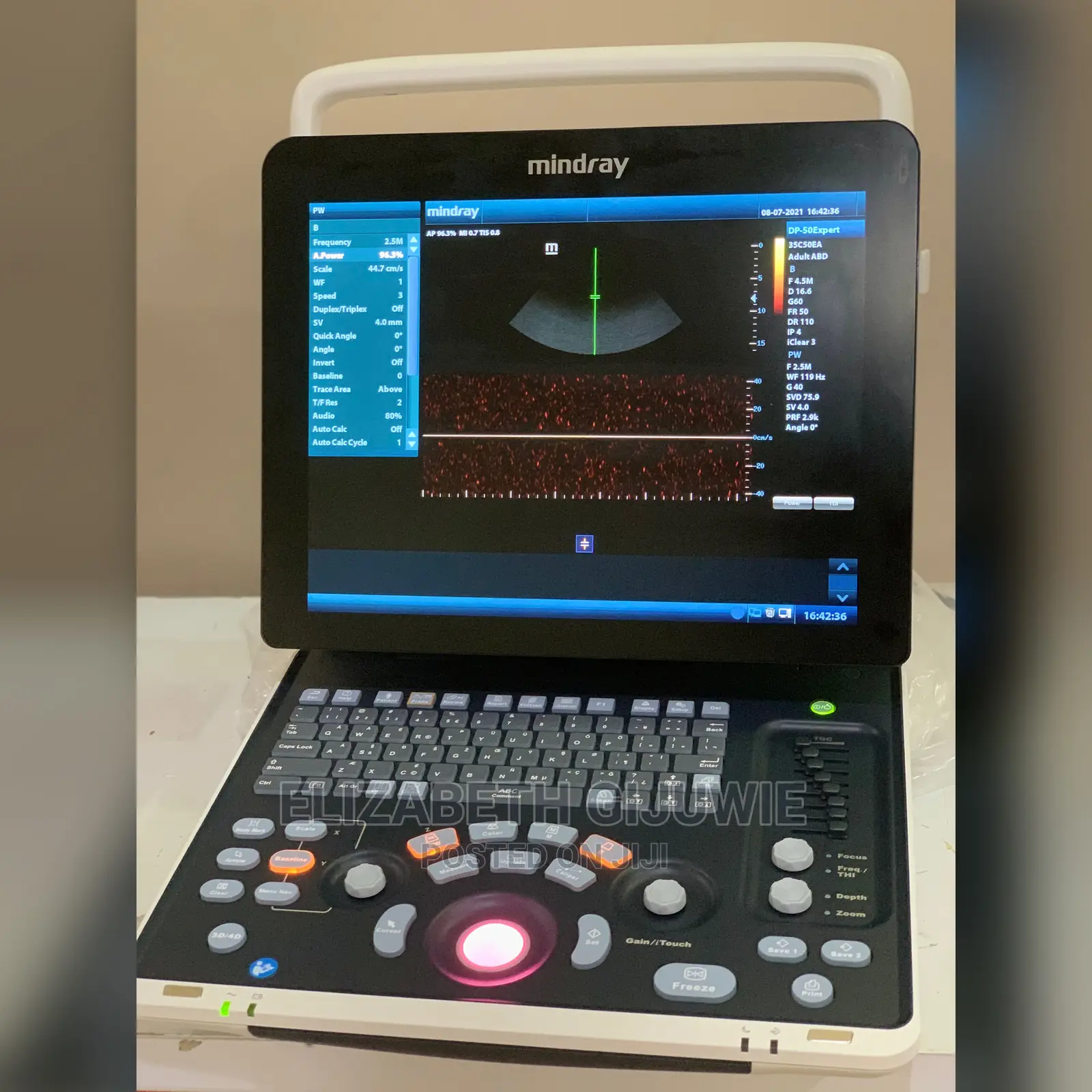 Mindray Dp50 Expert Ultrasound Machine