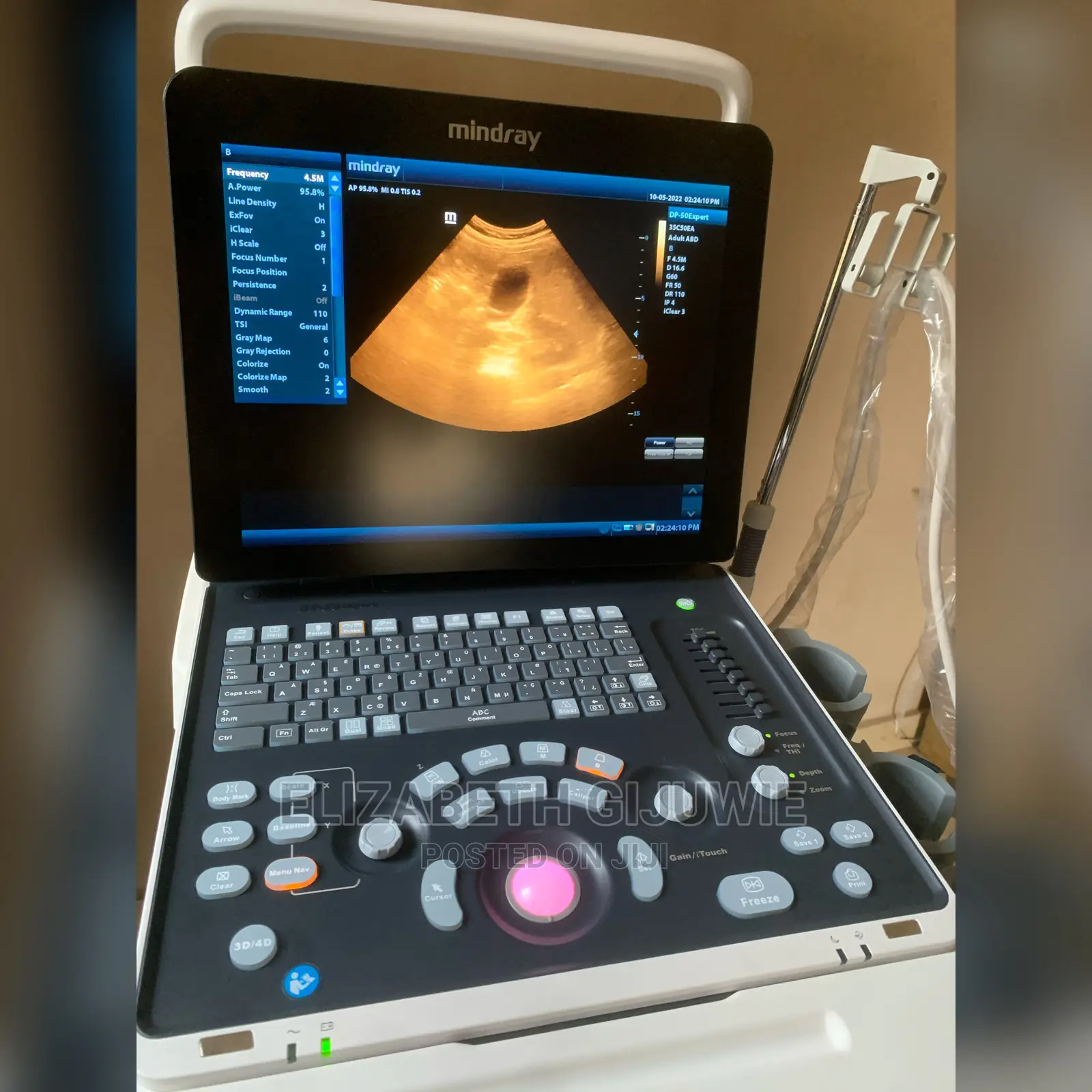 Mindray Dp50 Expert Ultrasound Machine