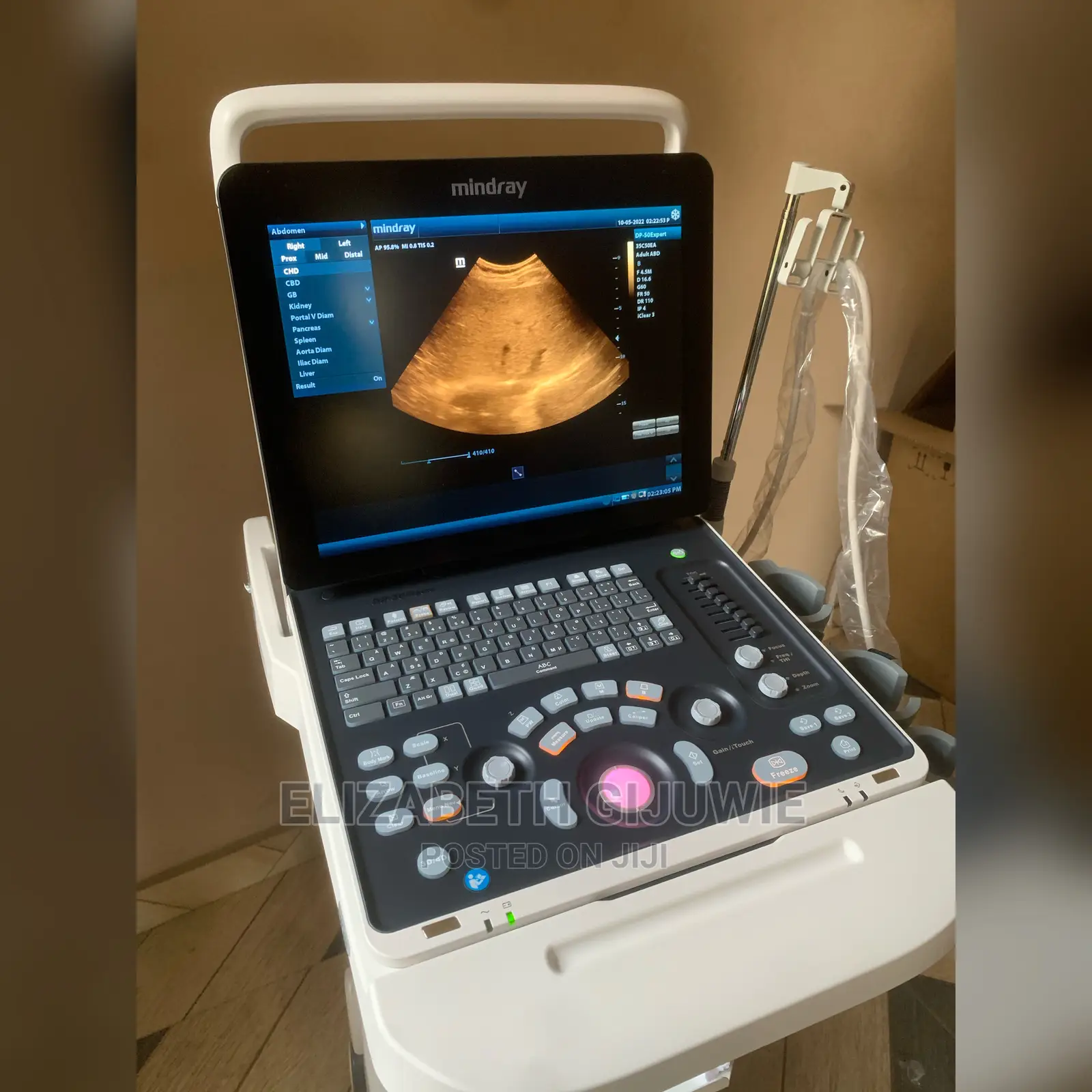 Mindray Dp50 Expert Ultrasound Machine
