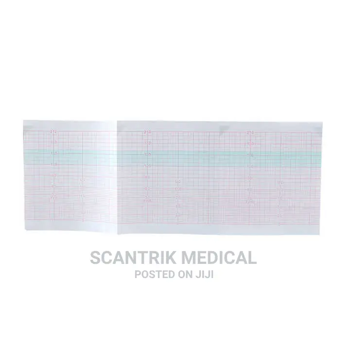 Easy to Use Quality ECG Thermal Paper