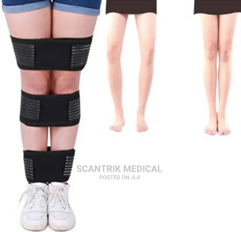 Legs Posture Corrector Bowed Legs Braces