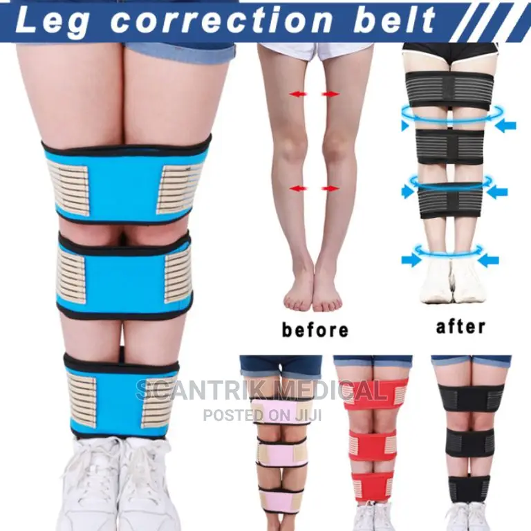 Bowed Legs Correction Belt Knock Knee Straightening