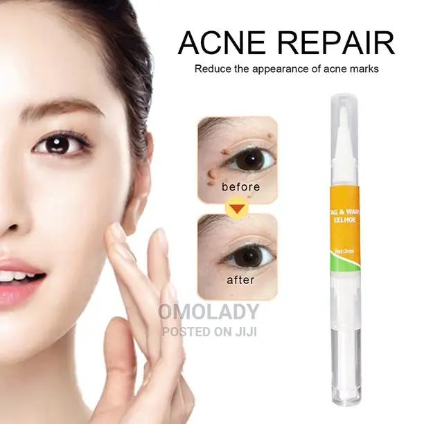 Eelhoe Tag and Wart Remover - 3ml