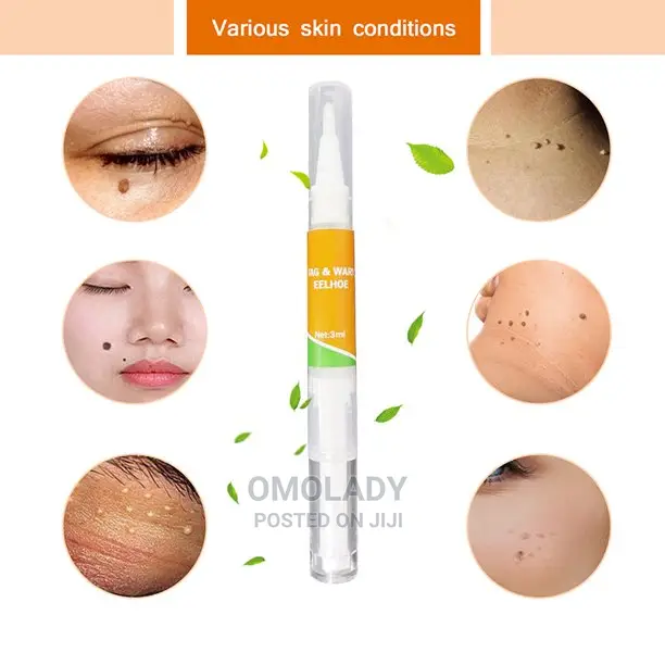 Eelhoe Tag and Wart Remover - 3ml