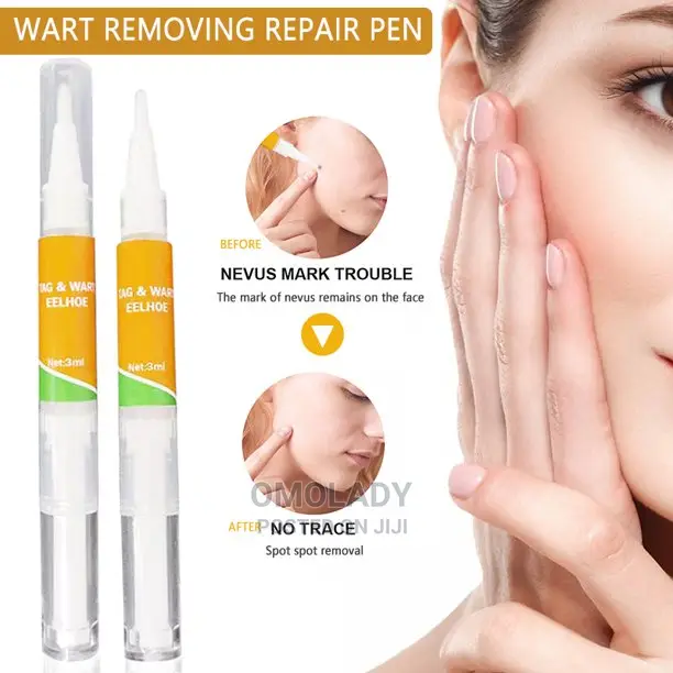 Eelhoe Tag and Wart Remover - 3ml