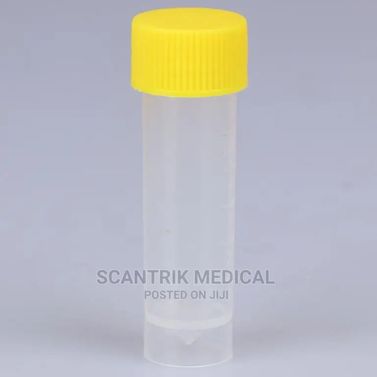 Portable Fluoride Vacuum Blood Specimen Collection Tube