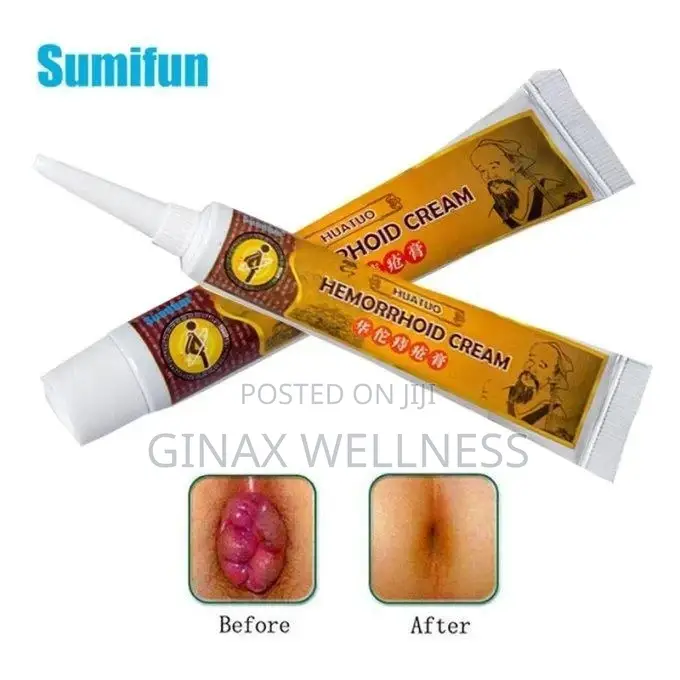 Hemorrhoid Cream | Topical Cream for Pile and Anal Fissures