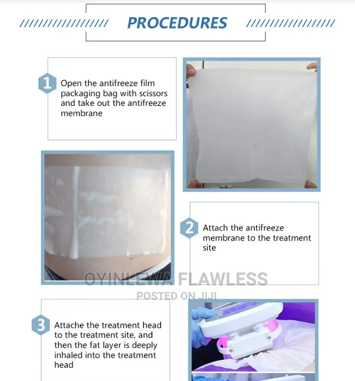 Quality Fat Freezing Cryolypolysis Membrane