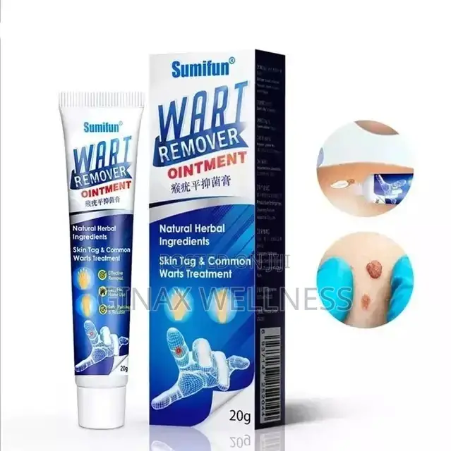 Warts Remover Ointment | Skin Tag Foot Corn Removal Cream