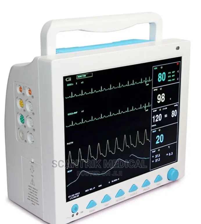 Hospital Bedside Patient Monitor