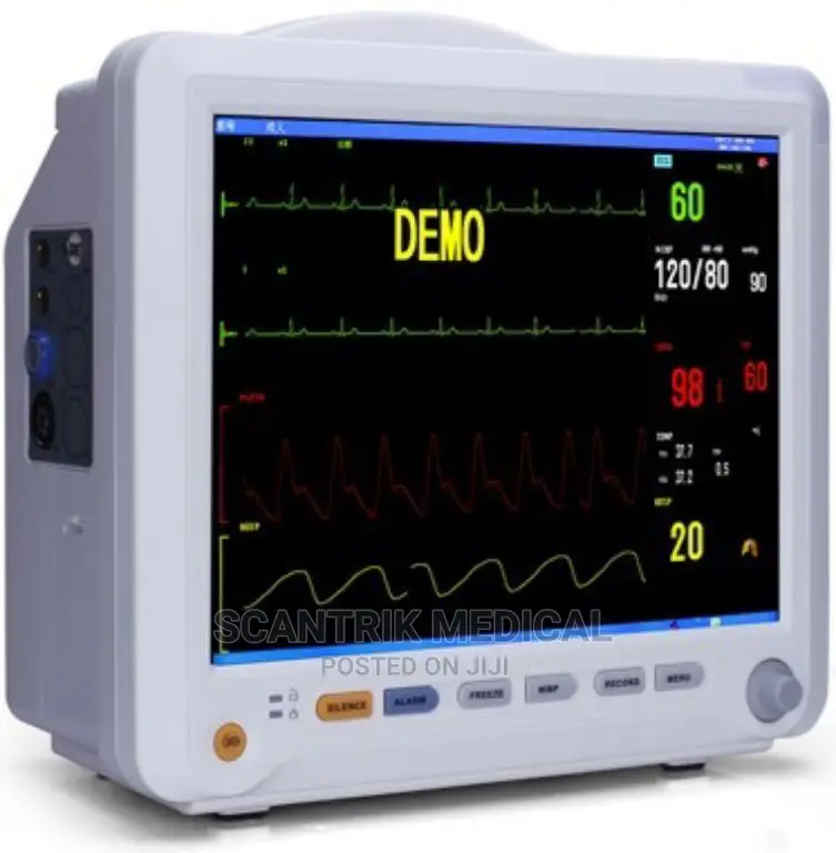 Patient Monitor Cart