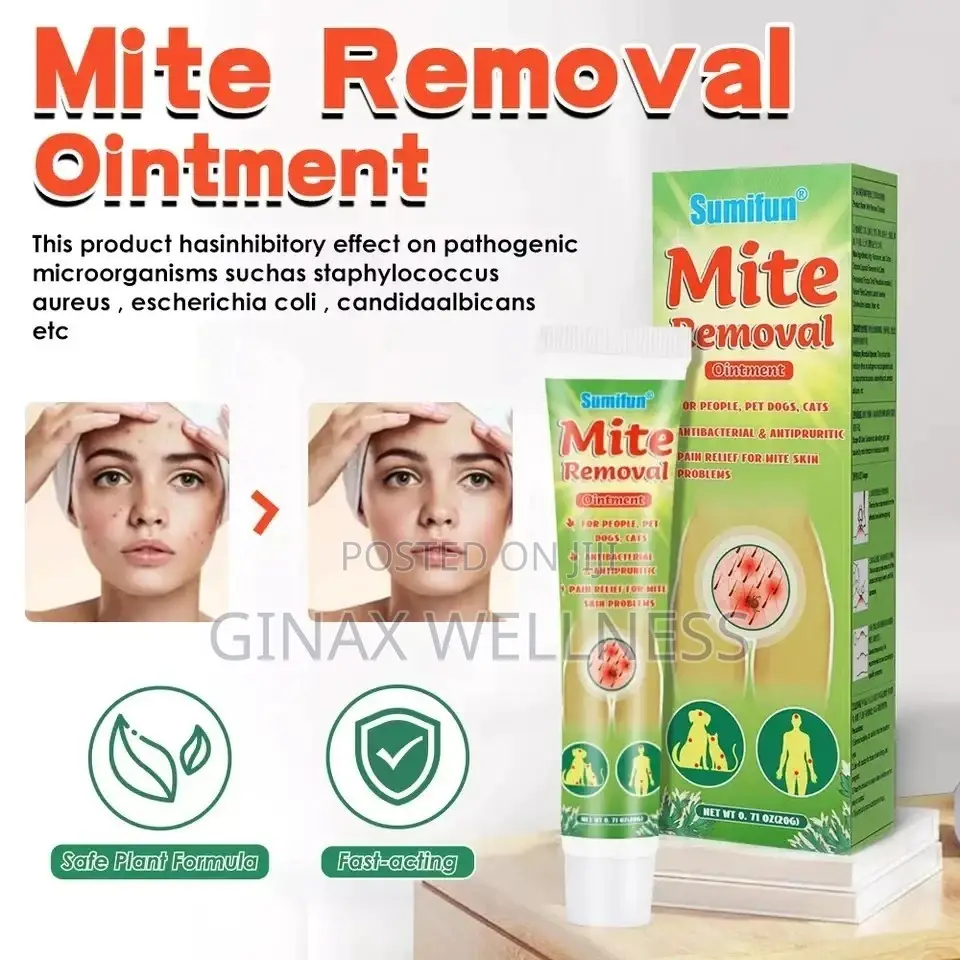 Mite Removal Ointment for Scabies Rash, Pubic Lice, Mites
