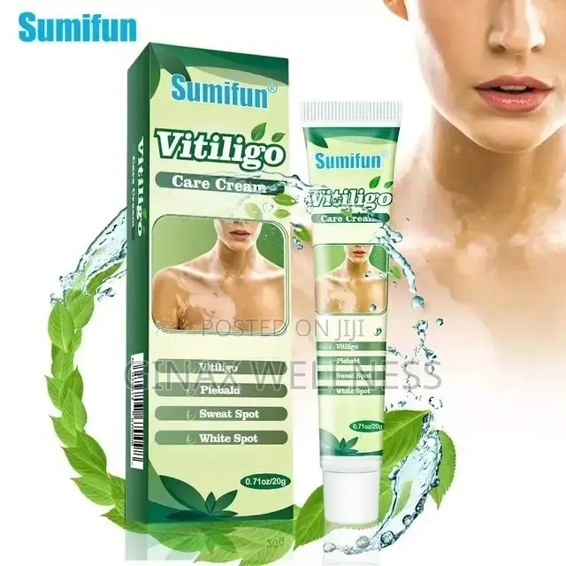 Vitiligo Care Cream