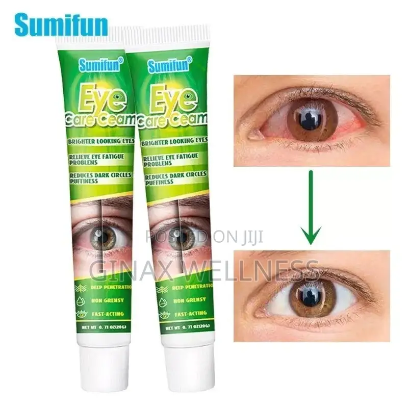 Eye Care Cream for Bright Eyes, Eye Fatigue, Dark Circle